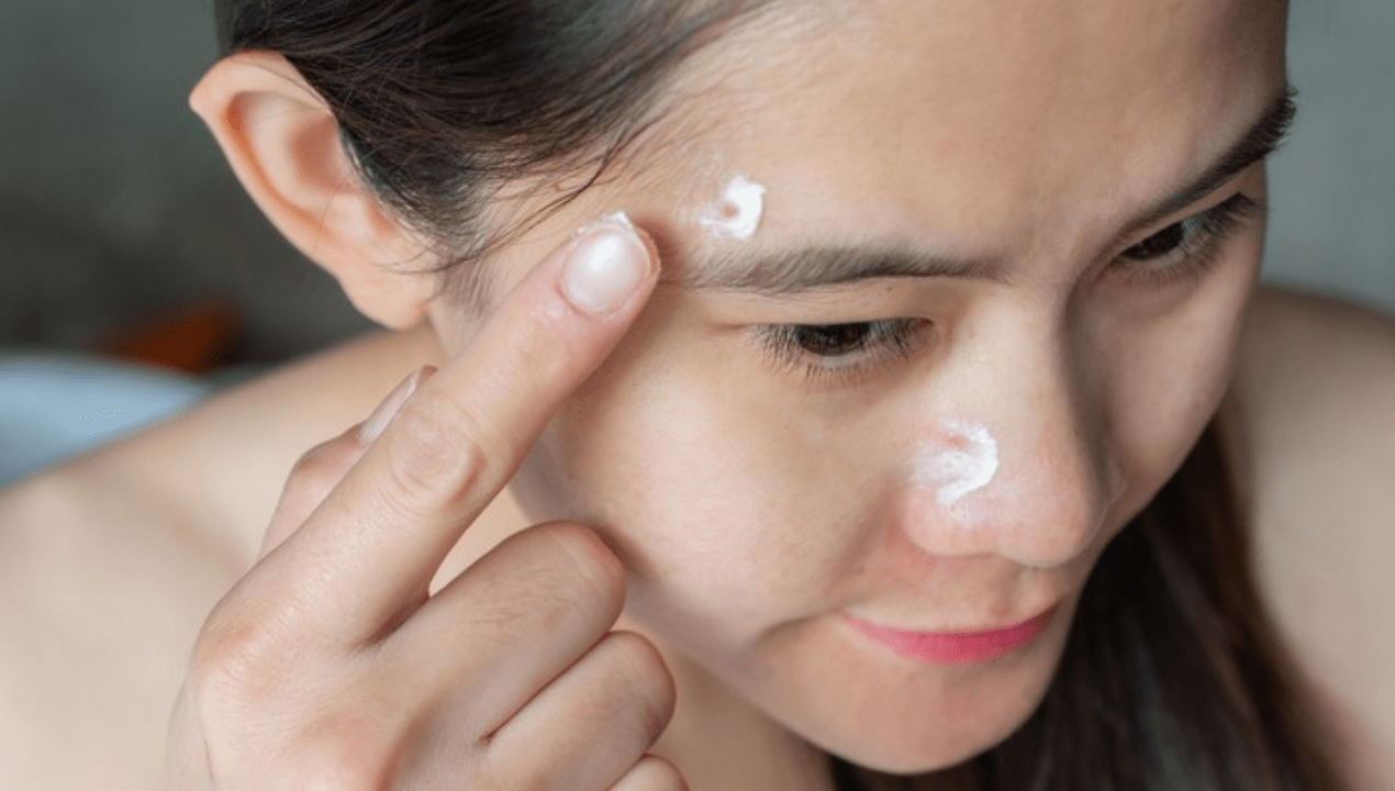 skincare kulit berjerawat