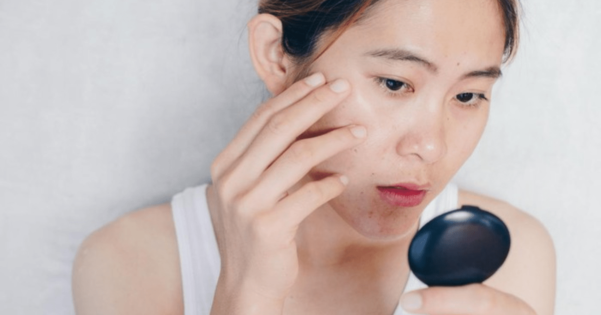 7 Penyebab Kulit Berminyak