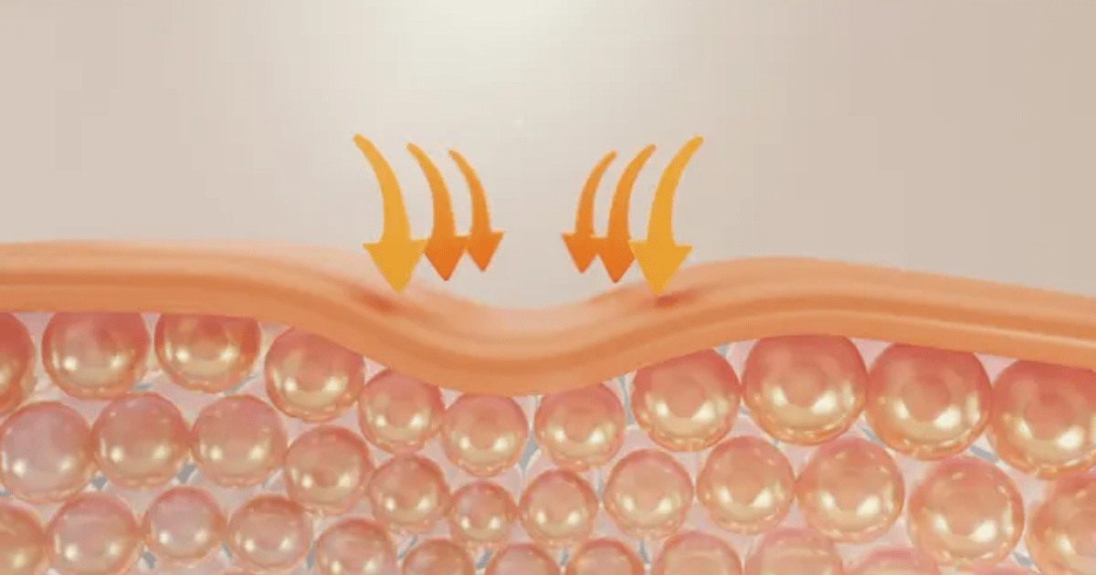 Cara Mengatasi Skin Barrier Rusak