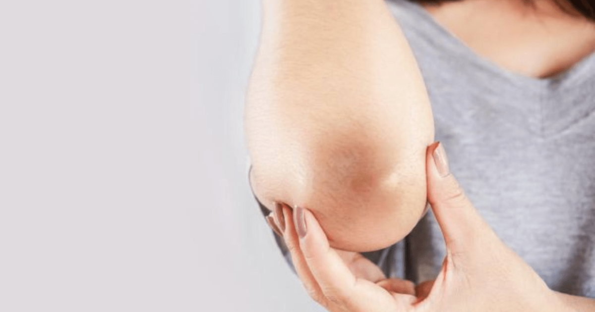 Cara memutihkan siku