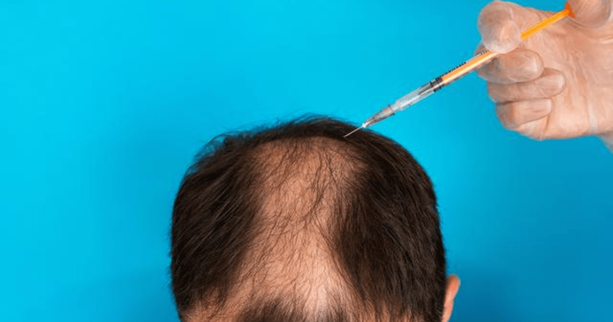 Stevia Potensi Mengobati Kebotakan